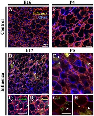 Ventricular-subventricular zone stem cell niche adaptations in a mouse model of post-infectious hydrocephalus
